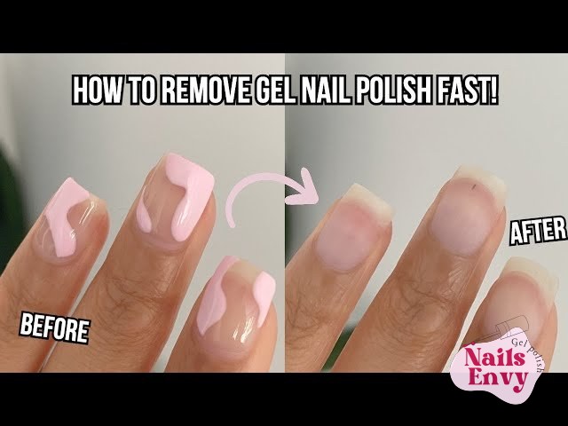 5 WAYS TO REMOVE GEL POLISH AT HOME A collage of five different methods for removing gel polish at home