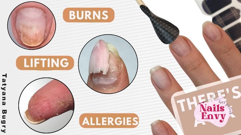 Quick fix for allergic reaction to gel nail polish