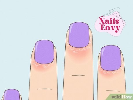 Step showing how to treat an allergic reaction to gel nail polish