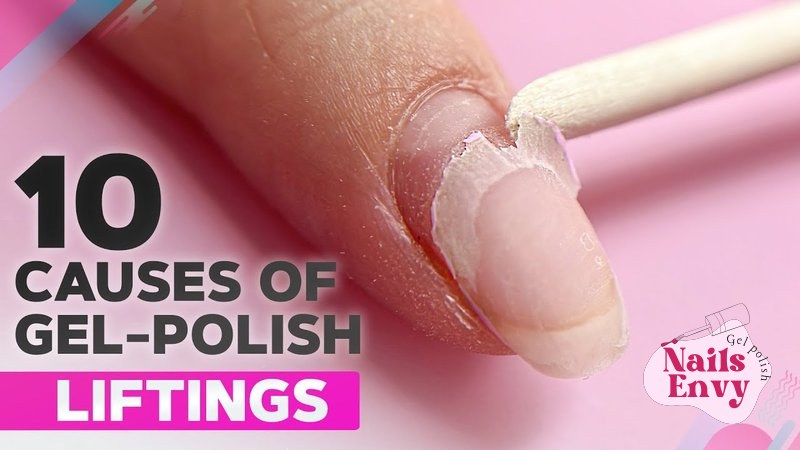 10 Causes of Gel Polish Peeling | Gel Lifting in the Cuticle Zone