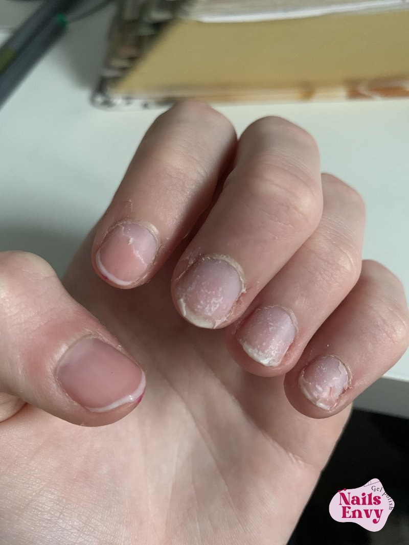 Gel/polish always peel right off?
