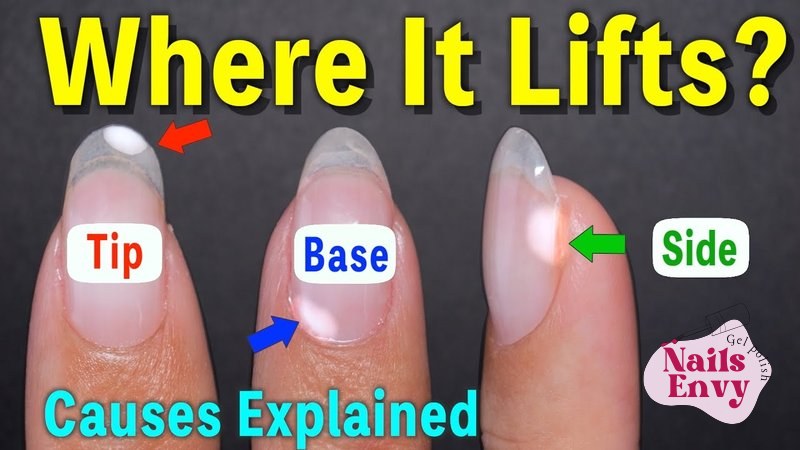 Why your gel nails keep peeling off: causes and fixes explained